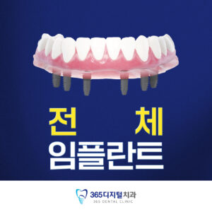 4)전체임플란트