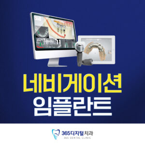 5)네비게이션임플란트