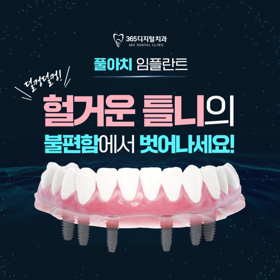 둔산동 풀아치임플란트 많은 치아 상실과 무치악 방치 주의사항 치료 선택 확인