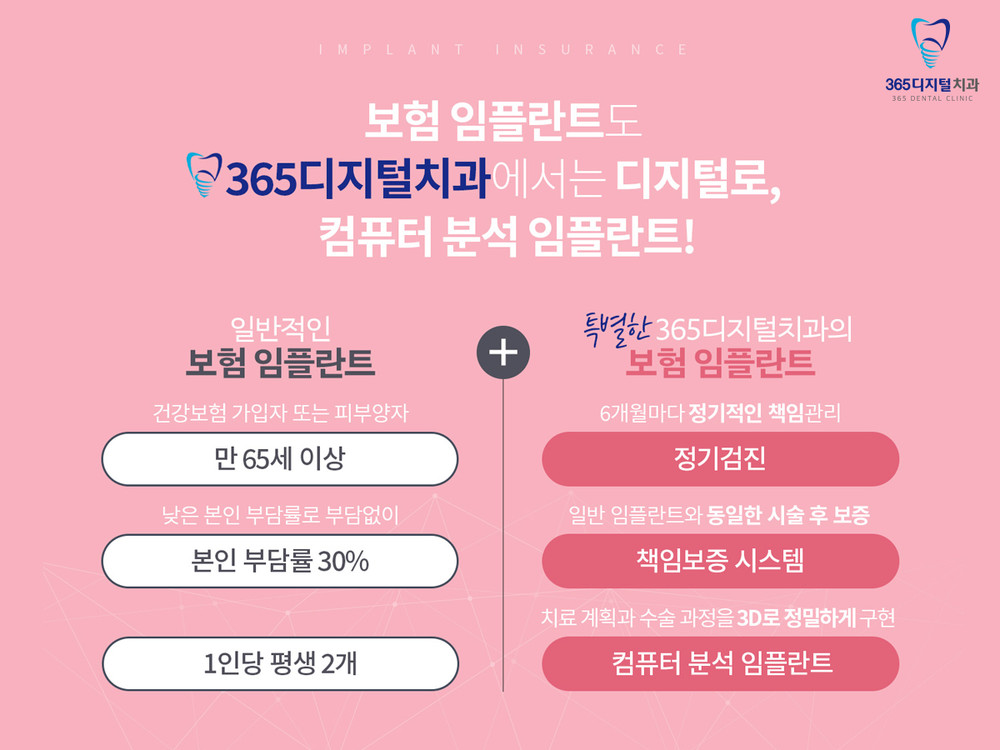 둔산동 전악임플란트 노화와 사고로 생긴 치아 상실 대체 치료 필요성 확인
