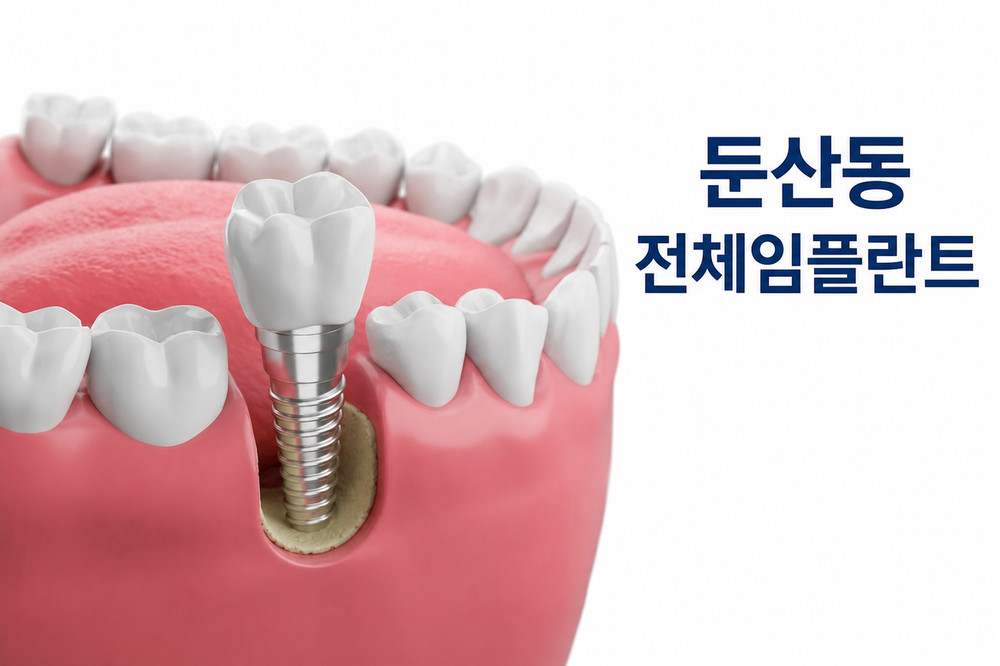 둔산동 전체임플란트 빠른 회복을 위한 충치 사고 외상 치아 상실 보완 필요성 확인점